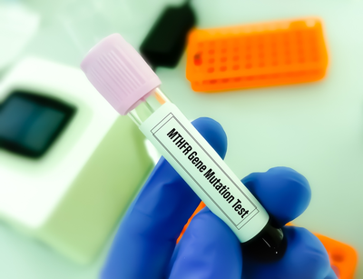 MTHFR gene mutation test