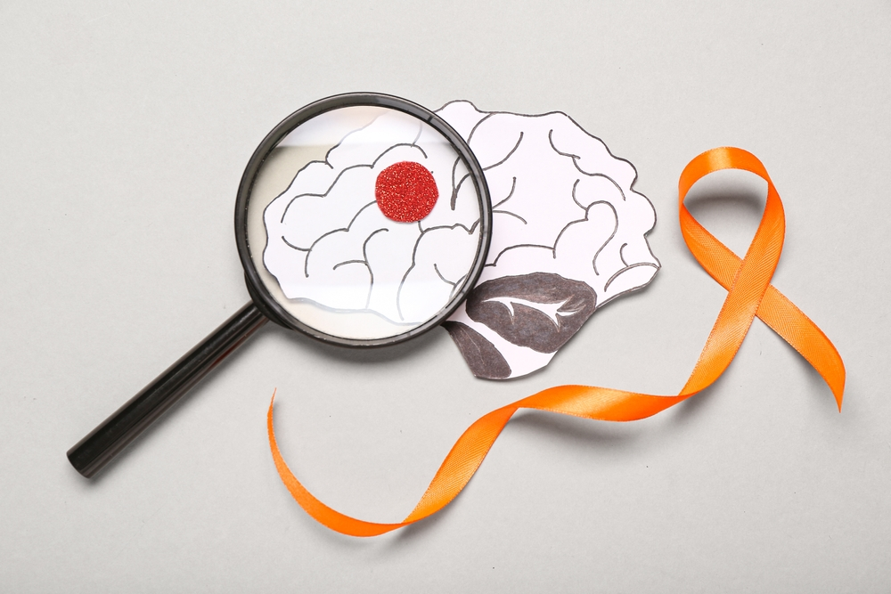 what causes MS